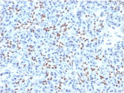 FFPE human pancreas sections stained with 100 ul anti-SOX9 (clone PCRP-SOX9-1A2) at 1:50. HIER epitope retrieval prior to staining was performed in 10mM Citrate, pH 6.0.